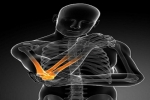 Tennis Elbow, Golf Elbow - Physical Therapy