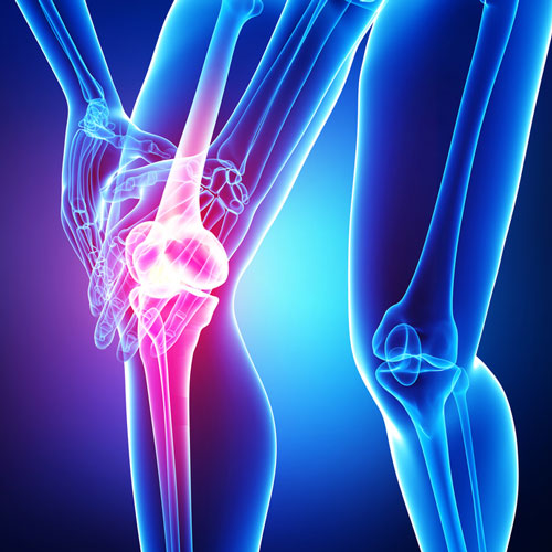 Iliotibial band Syndrome Symptoms & Best Way of Treatments